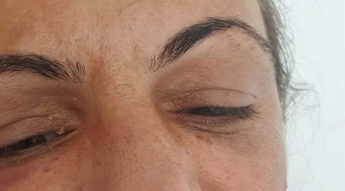 Femeie desfigurată de soțul de care divorțează! Agresorul nu a fost reținut