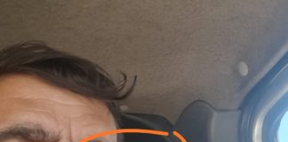 Salariat de la firma care lucrează la rețeaua de canalizare din Samarinești, agresat de viceprimar! ,,Mi-a dat un pumn în ochi!”