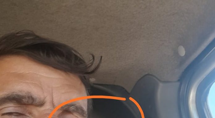 Salariat de la firma care lucrează la rețeaua de canalizare din Samarinești, agresat de viceprimar! ,,Mi-a dat un pumn în ochi!”