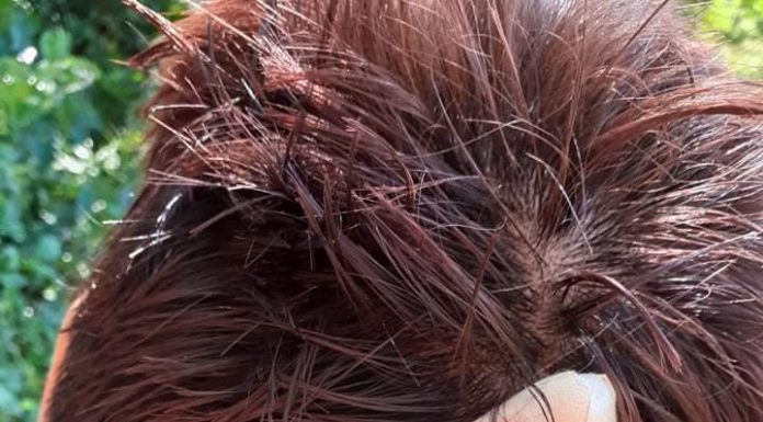 Dosar penal! Novaceancă lovită cu bolovanul în cap de cumnatul agresiv