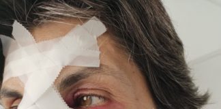 Leziuni traumatice, produse cu un corp dur! 16-18 zile de îngrijiri medicale pentru victima lui Vîlceanu