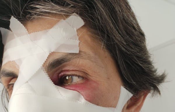 Leziuni traumatice, produse cu un corp dur! 16-18 zile de îngrijiri medicale pentru victima lui Vîlceanu