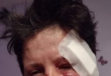 Victima unui accident rutier de la Moi, desfigurată la domiciliu! Ancheta, inexistentă