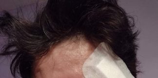 Victima unui accident rutier de la Moi, desfigurată la domiciliu! Ancheta, inexistentă