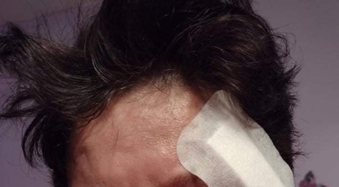 Victima unui accident rutier de la Moi, desfigurată la domiciliu! Ancheta, inexistentă