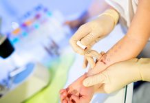 Tot mai mulți gorjeni cu alergii. Medic: Vârsta de apariție a alergiilor a scăzut foarte mult