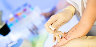 Tot mai mulți gorjeni cu alergii. Medic: Vârsta de apariție a alergiilor a scăzut foarte mult