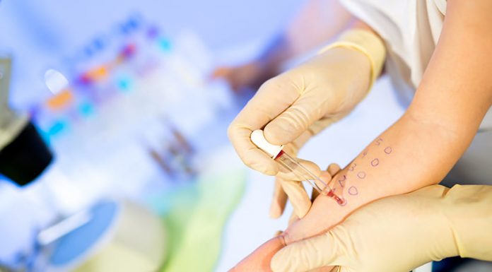 Tot mai mulți gorjeni cu alergii. Medic: Vârsta de apariție a alergiilor a scăzut foarte mult