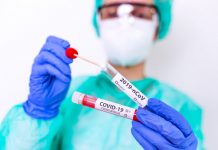 Covid: 882 cazuri noi și 7 decese