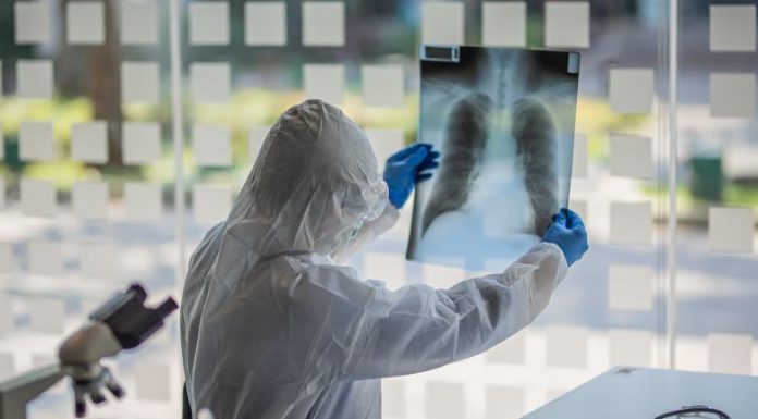 Bilanț Covid – 31.776 de cazuri, azi!