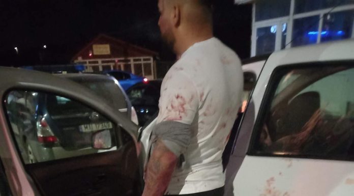 De unde a pornit scandalul din Clubul Babylon din Țicleni! Prima victimă, Alex ,,Jador”, s-a ales cu o sticlă în cap și tăieturi pe corp