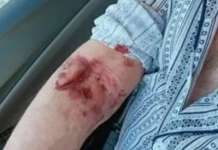 Asistente medicale sancționate la salariu. Bătrân rănit cu o foarfecă