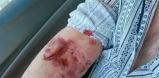 Asistente medicale sancționate la salariu. Bătrân rănit cu o foarfecă