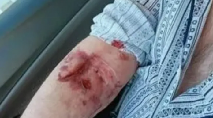 Asistente medicale sancționate la salariu. Bătrân rănit cu o foarfecă