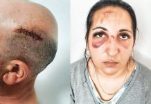 Gelozie de dosar penal! Au bătut cu bâtele o familie întreagă, dar agresorii, două femei din Polovragi și un tânăr, sunt în libertate