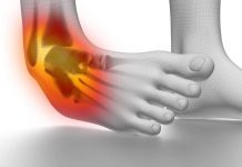 Ce sunt entorsele și cum se tratează