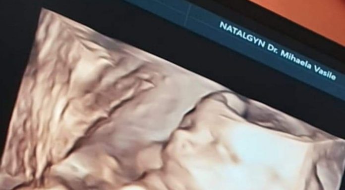 Șocant! O gravidă din Rovinari are copilul mort în ea de mai bine de o săptămână! Este internată, de vineri, în Spitalul nr.1 Craiova