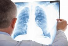 Caravană mobilă pentru depistarea tuberculozei în 11 comune din Gorj