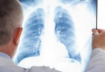 Radiografii gratuite la Bălești!