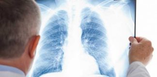 Radiografii gratuite la Bălești!