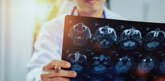 Lămâie sau banană? Neurologii nu doresc să le vadă pe imaginile de CT cerebral!