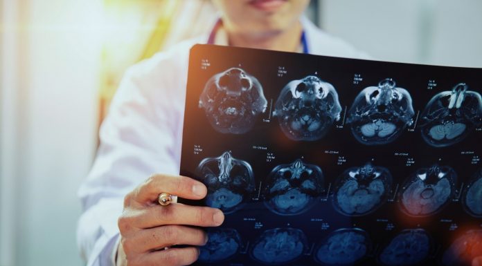 Lămâie sau banană? Neurologii nu doresc să le vadă pe imaginile de CT cerebral!