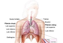 Cancerul bronhopulmonar