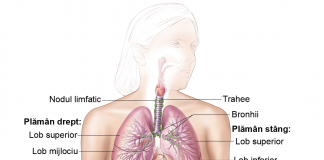Cancerul bronhopulmonar