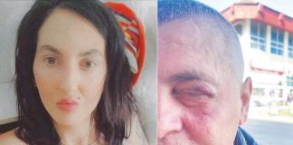 Bărbat din Târgu-Jiu, bătut de proxenetul fostei neveste! Medic legist: Au pus în primejdie viața victimei!