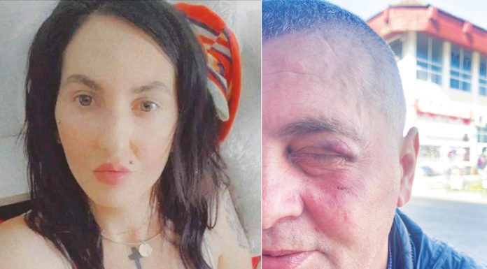 Bărbat din Târgu-Jiu, bătut de proxenetul fostei neveste! Medic legist: Au pus în primejdie viața victimei!