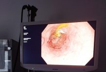 Aparatură ultraperformantă la Secția de Gastroenterologie