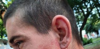 Cauza brancardierului cu bocancul imprimat pe față, disjunsă de Parchetul Militar! Cinci jandarmi, scoși din cauză, trei polițiști și fiul patronul Clubului ,,Babylon”, cercetați