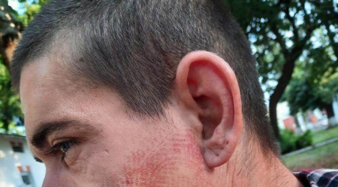 Cauza brancardierului cu bocancul imprimat pe față, disjunsă de Parchetul Militar! Cinci jandarmi, scoși din cauză, trei polițiști și fiul patronul Clubului ,,Babylon”, cercetați