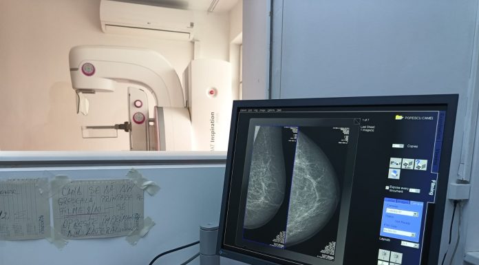 Mamografii 3D la Spitalul Județean