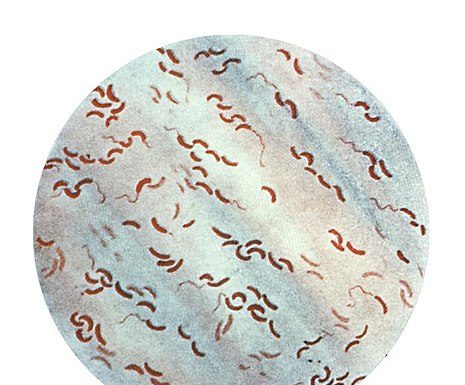 OMS: Pericol de holeră la Marea Neagră!