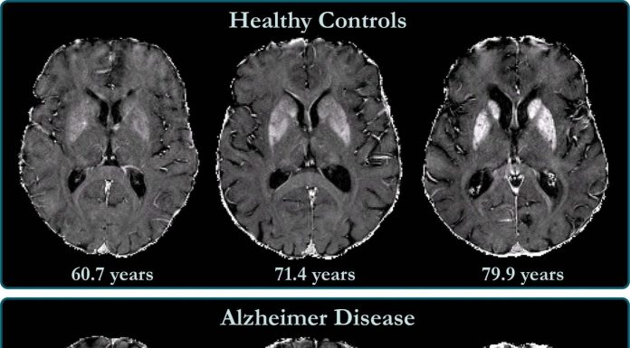 Totul despre tulburările deteriorativ-demențiale