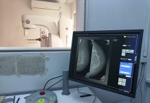 Primele mamografii 3D efectuate la Spitalul Județean