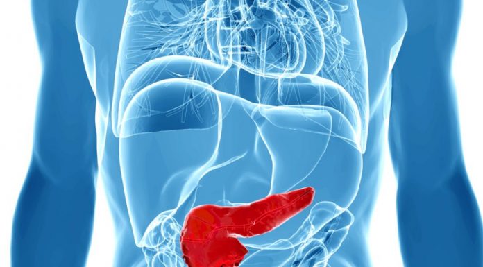 Câți gorjeni suferă de cancer pancreatic