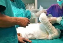 Investiție de 56 milioane de euro pentru tratarea pacienților cu arsuri