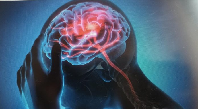 Ministerul Sănătății: Anual, peste 60.000 de români suferă un AVC