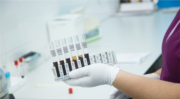 Analize medicale gratuite la Spitalul Județean. Cum poți beneficia de ele!