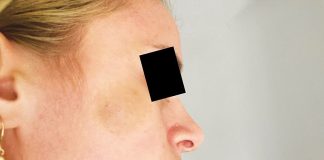 Arestat la domiciliu după ce și-a bătut fosta parteneră!