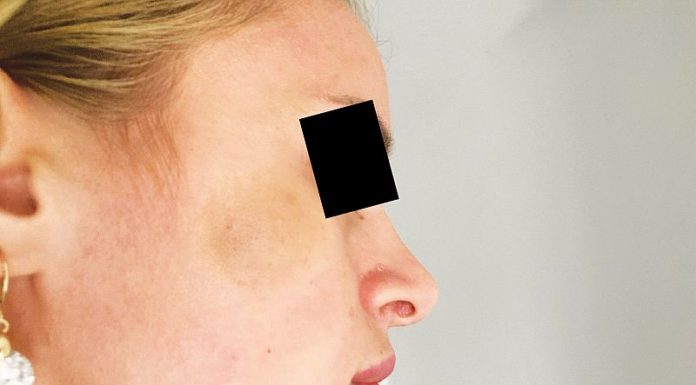 Arestat la domiciliu după ce și-a bătut fosta parteneră!