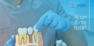 Implanturi Dentare: Calitate și Confort la City Dental Clinic Târgu Jiu