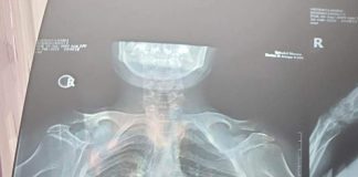 Strigăt de ajutor pentru o adolescentă din Bengești-Ciocadia