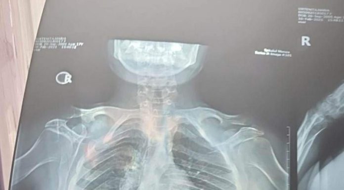 Strigăt de ajutor pentru o adolescentă din Bengești-Ciocadia