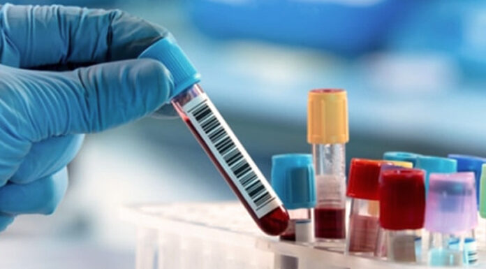 Spitalul Județean cumpără reactivi de 3 milioane de euro