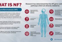 Neurofibromatoza: O boală genetică rară