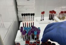 Analize medicale gratuite pentru gorjeni – află cum și unde!