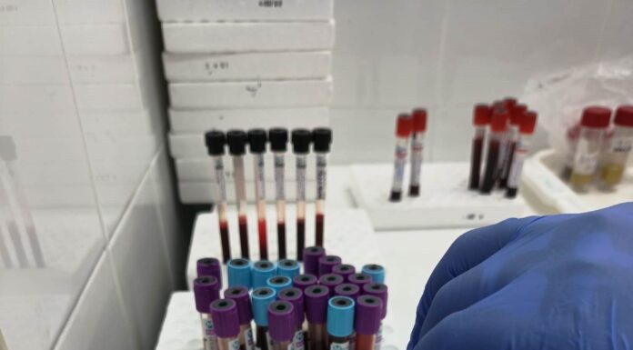 Analize medicale gratuite pentru gorjeni – află cum și unde!